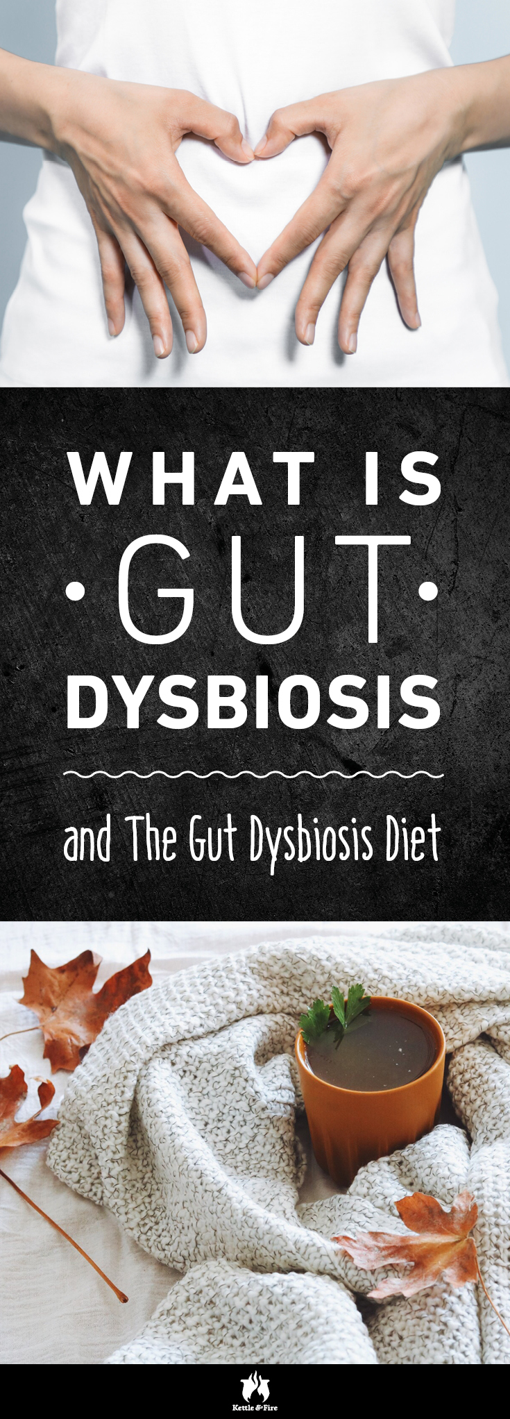 Acne? Allergies? Autoimmune conditions? Your symptoms could be caused by a bacterial condition that affects 30 million Americans, called gut dysbiosis.