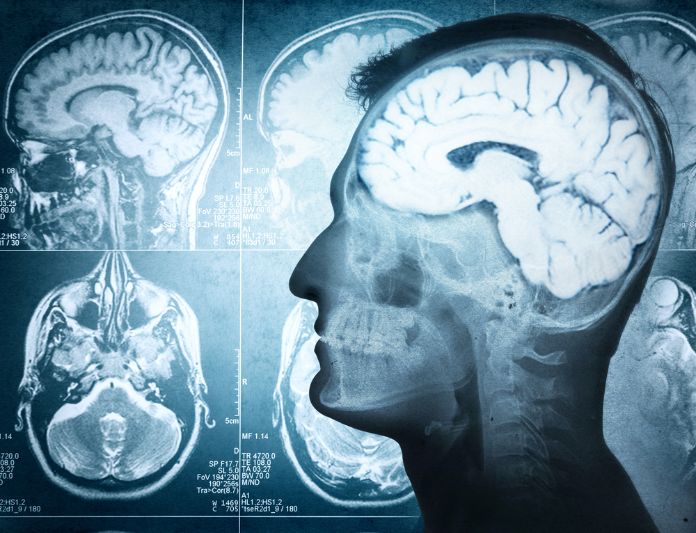 Gut Brain Axis