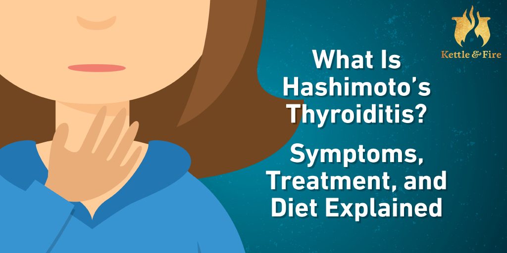 What Is Hashimoto S Thyroiditis Symptoms Treatment And Diet Explained   What Is Hashimoto’s Thyroiditis. Symptoms Treatment And Diet Explained Cover 1024x512 