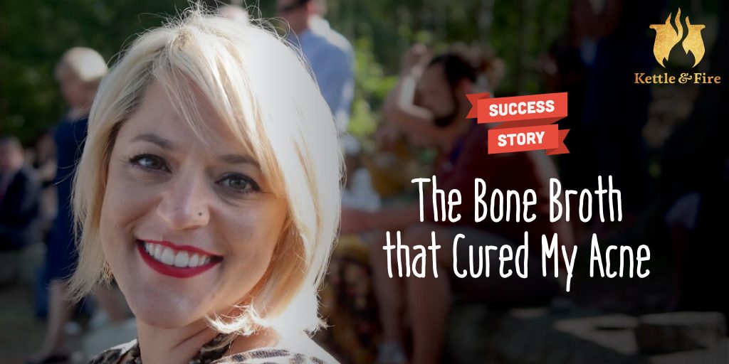 The Bone Broth that Cured My Acne