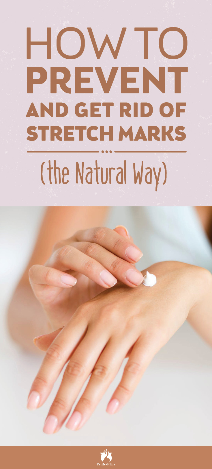 Stretch marks. They can happen to anyone—and often do. Learn how to get rid of stretch marks and better yet, how to prevent them the natural way. 